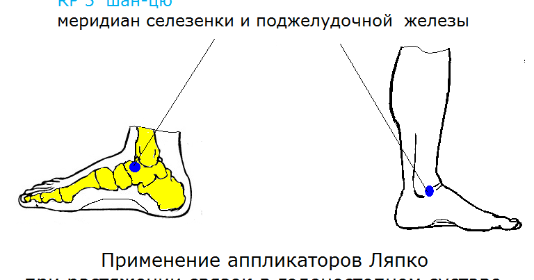 Стоимость операция при разрыве мениска коленного сустава